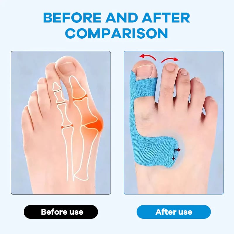 🛡️ Premium Pre-Cut Bunion Tape | Sweatproof Elastic Athletic Tape for All-Day Wear 🩹✨