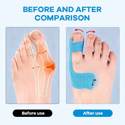 🛡️ Premium Pre-Cut Bunion Tape | Sweatproof Elastic Athletic Tape for All-Day Wear 🩹✨