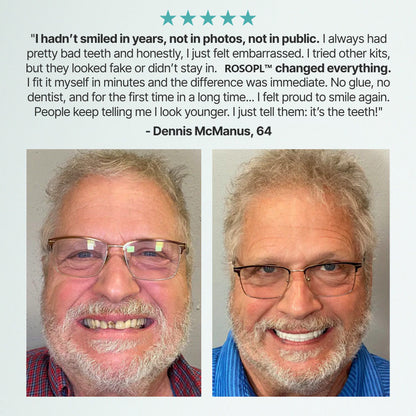 𝑶𝒇𝒇𝒊𝒄𝒊𝒂𝒍 𝑺𝒕𝒐𝒓𝒆 | Primglam® Custom-Fit Full Functional Dentures Make you more confident✨