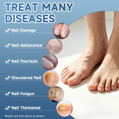 3-Day Maximum Intensity Nail Fungus Treatment - Fast-Acting Liquid Drops
