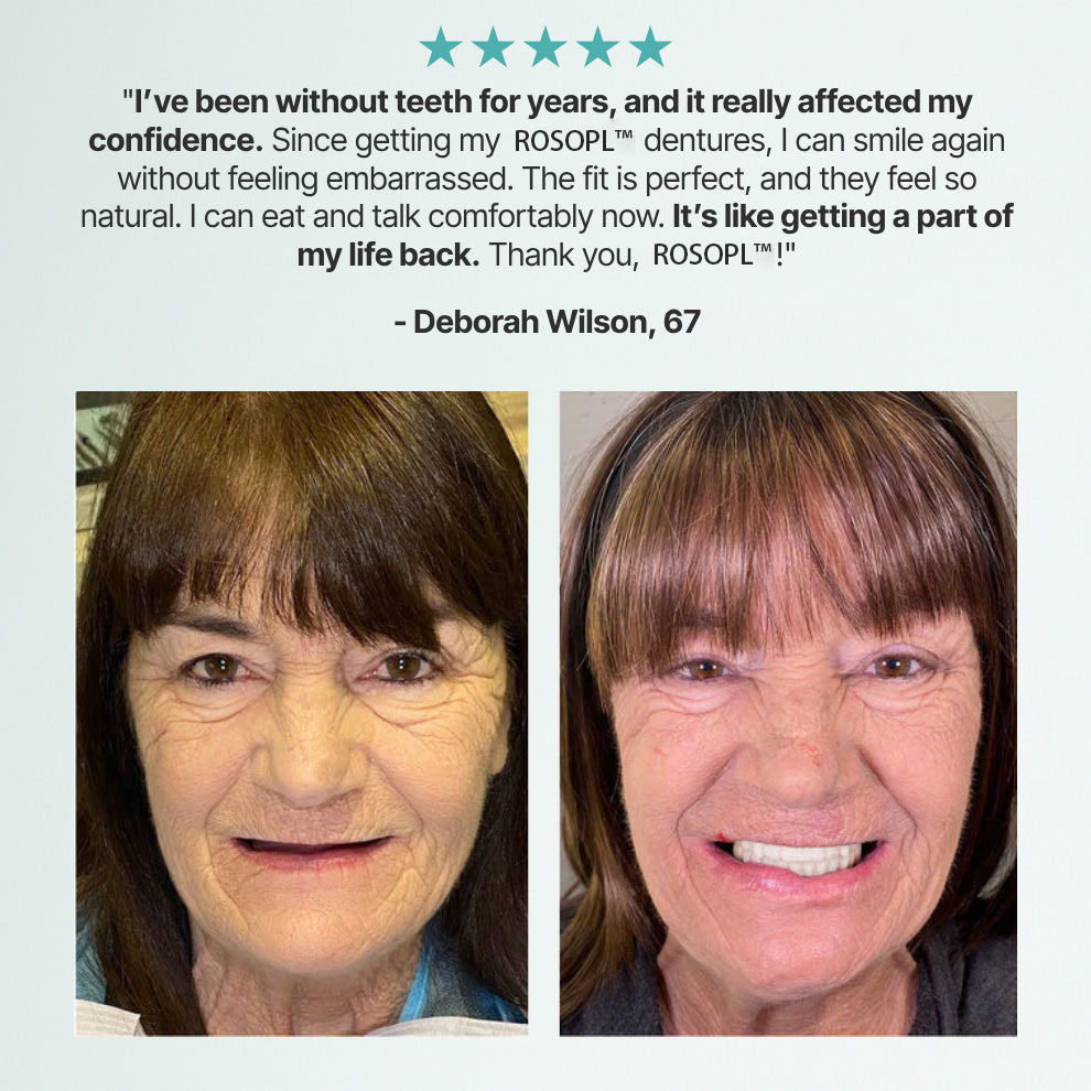 𝑶𝒇𝒇𝒊𝒄𝒊𝒂𝒍 𝑺𝒕𝒐𝒓𝒆 | Primglam® Custom-Fit Full Functional Dentures Make you more confident✨