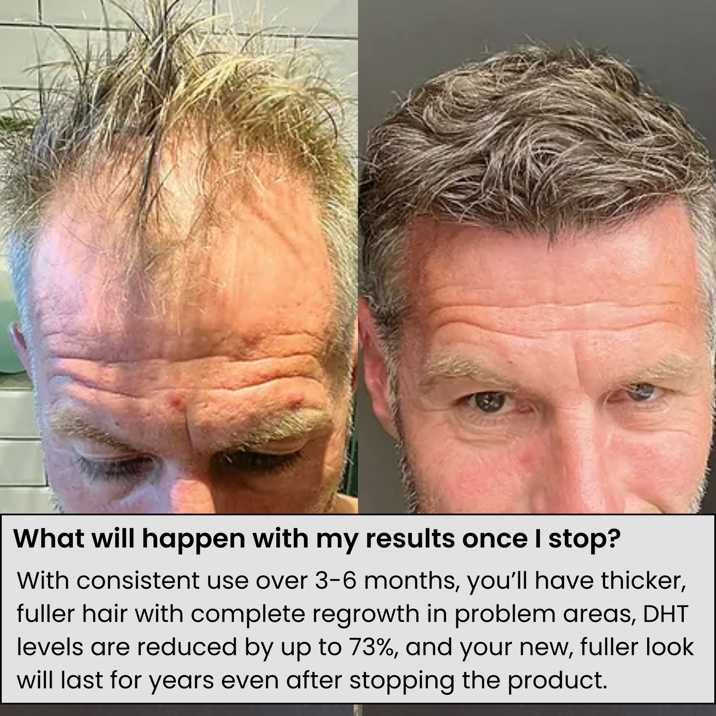 𝐎𝐟𝐟𝐢𝐜𝐢𝐚𝐥 𝐁𝐫𝐚𝐧𝐝 𝐒𝐭𝐨𝐫𝐞 | Primglam® Hair Regrowth System
