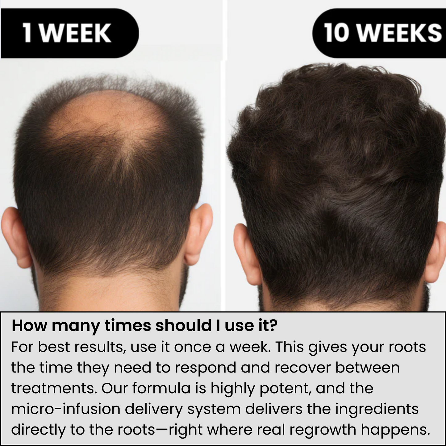 𝐎𝐟𝐟𝐢𝐜𝐢𝐚𝐥 𝐁𝐫𝐚𝐧𝐝 𝐒𝐭𝐨𝐫𝐞 | Primglam® Hair Regrowth System