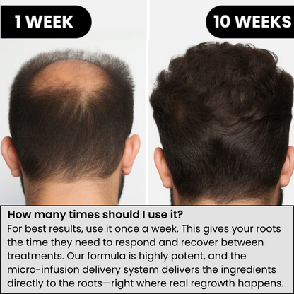 𝐎𝐟𝐟𝐢𝐜𝐢𝐚𝐥 𝐁𝐫𝐚𝐧𝐝 𝐒𝐭𝐨𝐫𝐞 | Primglam® Hair Regrowth System